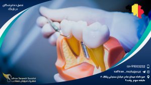 تحصیل دندانپزشکی در بلژیک