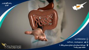 رشته گوارش در قبرس