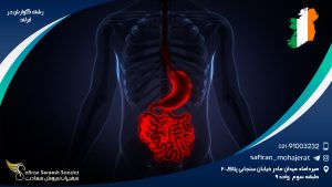 رشته گوارش در ایرلند
