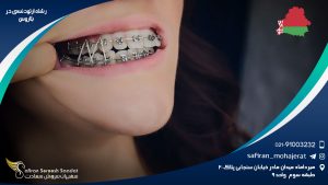 رشته ارتودنسی در بلاروس