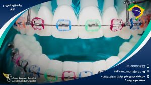 رشته ارتودنسی در برزیل