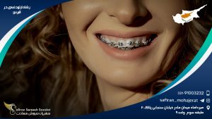 رشته ارتودنسی در قبرس