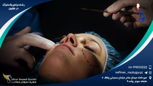 رشته جراحی پلاستیک در فیلیپین