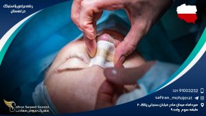 رشته جراحی پلاستیک در لهستان