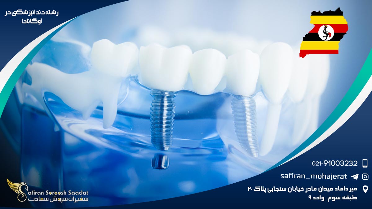 ضوابط دریافت پذیرش رشته دندانپزشکی در اوگاندا رشته دندانپزشکی در اوگاندا