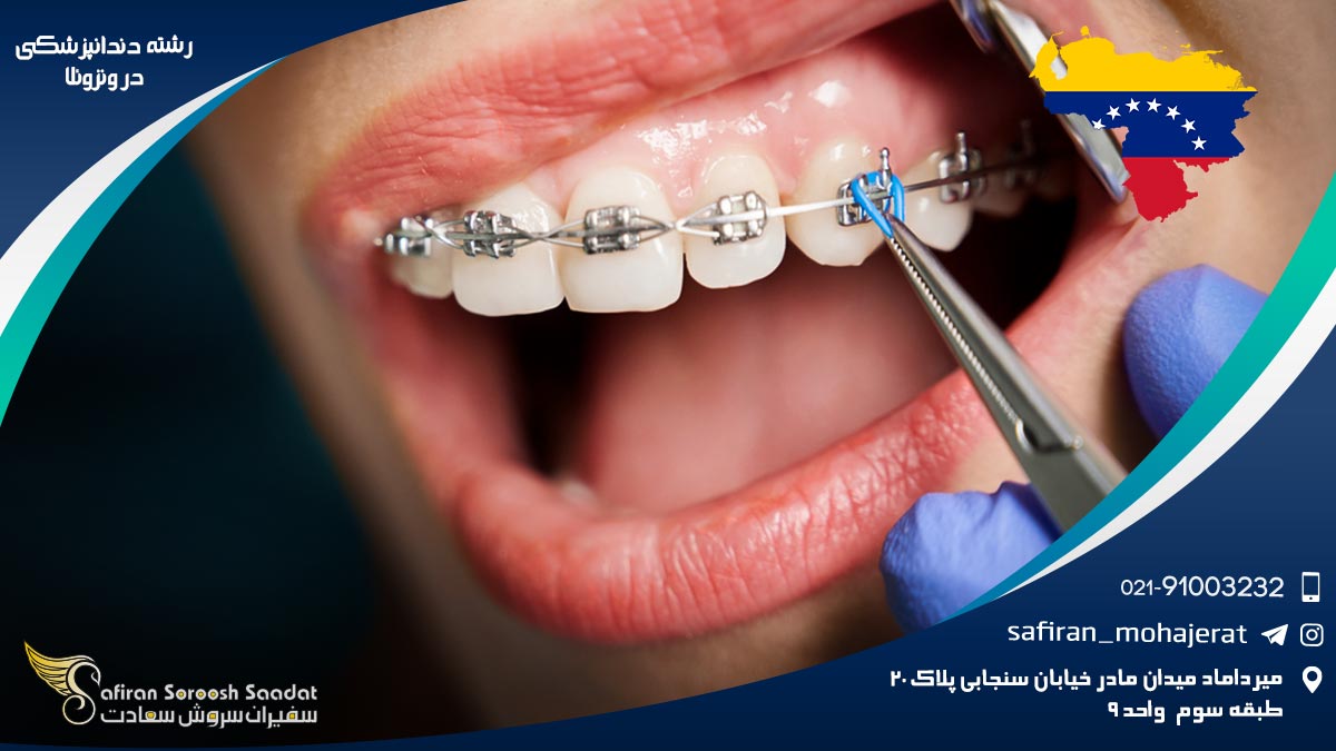 مزایا و معایب تحصیل رشته دندانپزشکی در ونزوئلا رشته دندانپزشکی در ونزوئلا