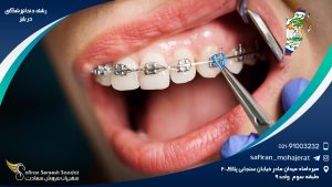 رشته دندانپزشکی در بلیز
