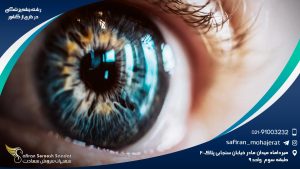 رشته چشم پزشکی در خارج از کشور