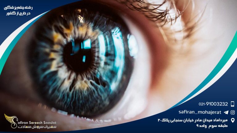 رشته چشم پزشکی در خارج از کشور